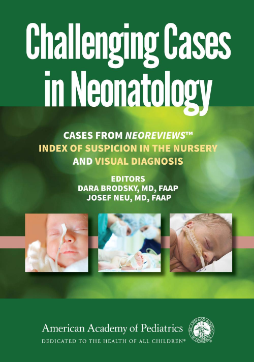 View cover