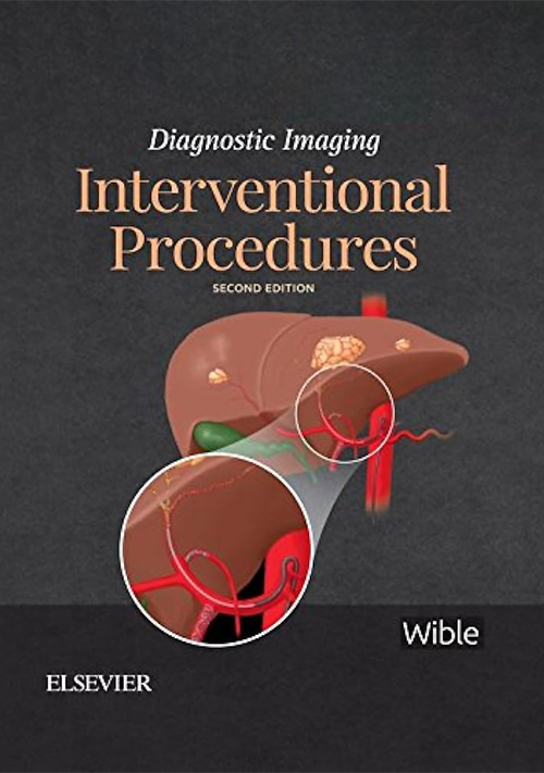 View cover
