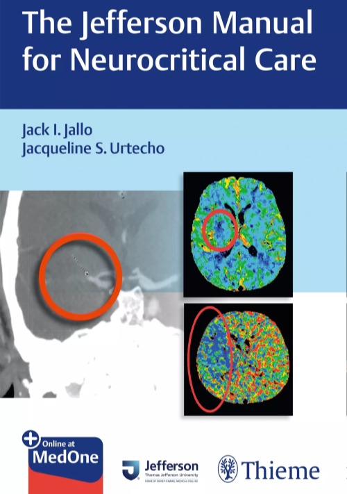 View cover