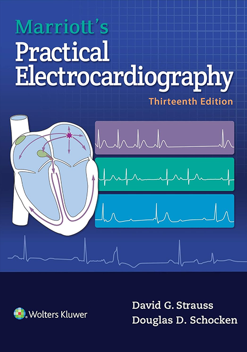 View cover