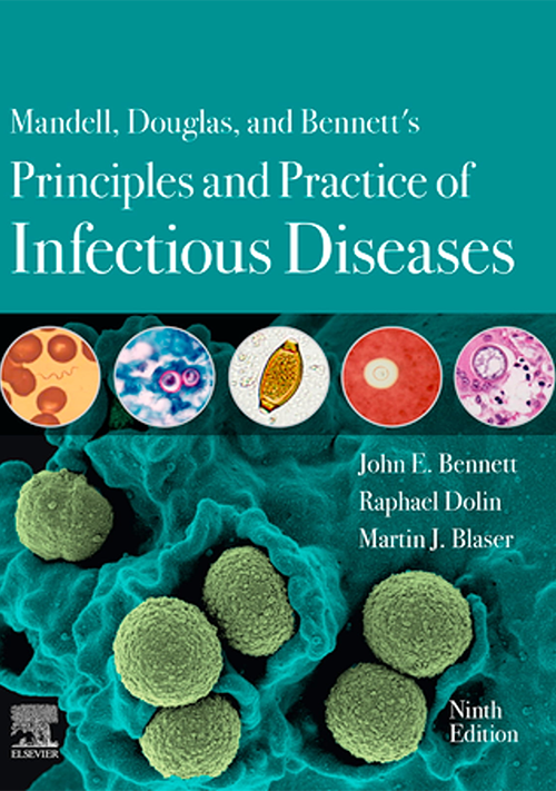 View cover