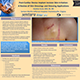 Skin Irritation Poster Thumbnail